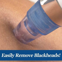2 in 1 Blackhead Whitehead Extractor Remover Device (Multi-Color / 1 Set / batteries not included) - dailyneed.life