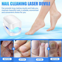 Rechargeable Nail Fungus Laser – Anti-Fungal Device for Toenails, Hands & Feet (Home Use) - dailyneed.life