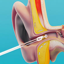 Ear wax Cleaner Stick Silicone Reusable Sticky Ear wax Removal Kit (12 Pcs Set) - dailyneed.life