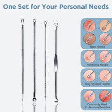 Blackhead Remover, 4-in-1 Stainless Steel Pimple Extractor Tool (1 Pc) - dailyneed.life