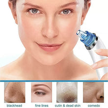 2 in 1 Blackhead Whitehead Extractor Remover Device (Multi-Color / 1 Set / batteries not included) - dailyneed.life