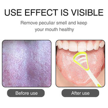 Oral Tongue Cleaner Brush Scraper Health Personal Care Dental Care Tongue Cleaner (1 Pc / Multicolor) - dailyneed.life