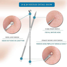 Blackhead Remover, 4-in-1 Stainless Steel Pimple Extractor Tool (1 Pc) - dailyneed.life