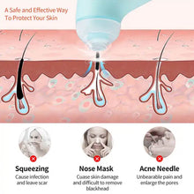 Mini Handheld Vacuum Blackhead Remover – Facial Massage & Spot Lifting (1 Pc) - dailyneed.life