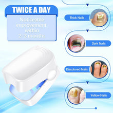Rechargeable Nail Fungus Laser – Anti-Fungal Device for Toenails, Hands & Feet (Home Use) - dailyneed.life