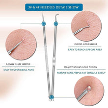 Blackhead Remover, 4-in-1 Stainless Steel Pimple Extractor Tool (1 Pc) - dailyneed.life