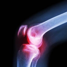 (XL) Knee Cap for Knee Support - dailyneed.life