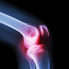 Knee Cap for Knee Support (Large) - dailyneed.life