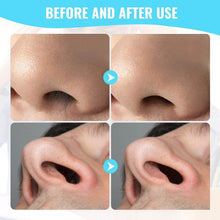 Nose Hair Removal Trimmer Nose Hair Remover Razor Kit Blade (3 Pcs Set) - dailyneed.life