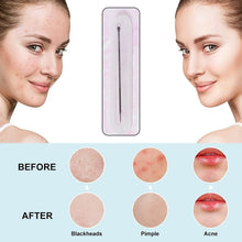 Blackhead Remover Needle (1 Pc / With Case) - dailyneed.life