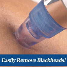 4 In 1 Blackhead Whitehead Extractor Remover Device Acne Pimple Pore Cleaner (Vacuum Suction Tool) - dailyneed.life